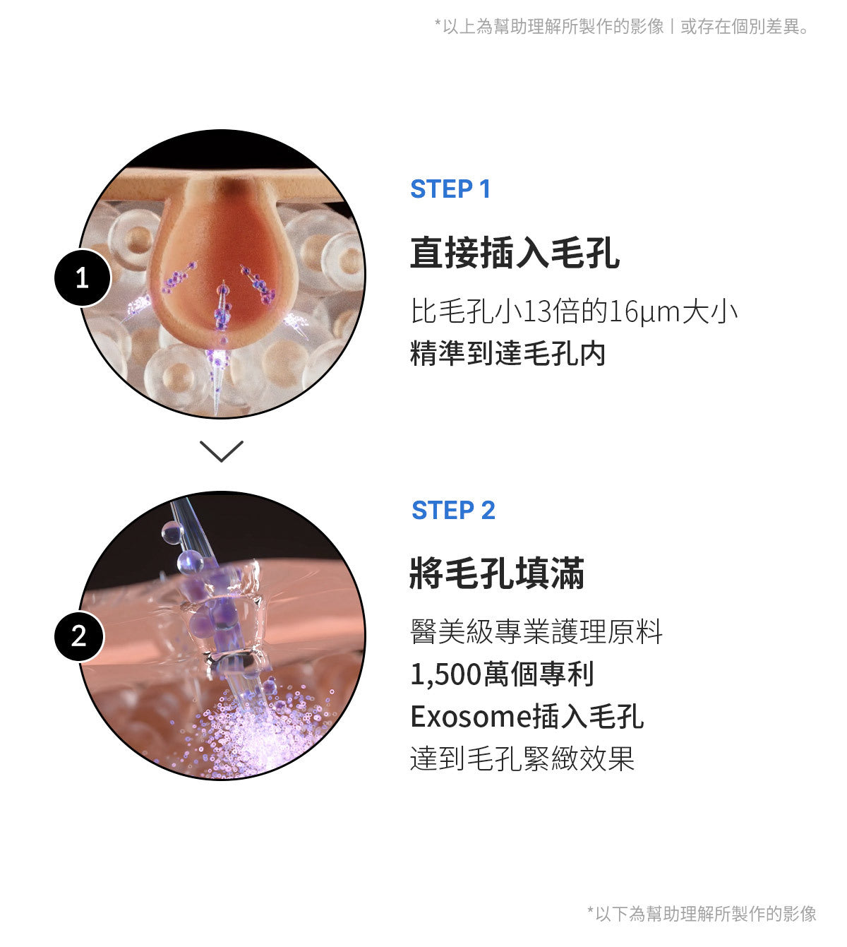 Medicube - ZERO微針全效毛孔安瓶 7,500ppm (外泌體醫美級強效緊緻毛孔精華) 30ml